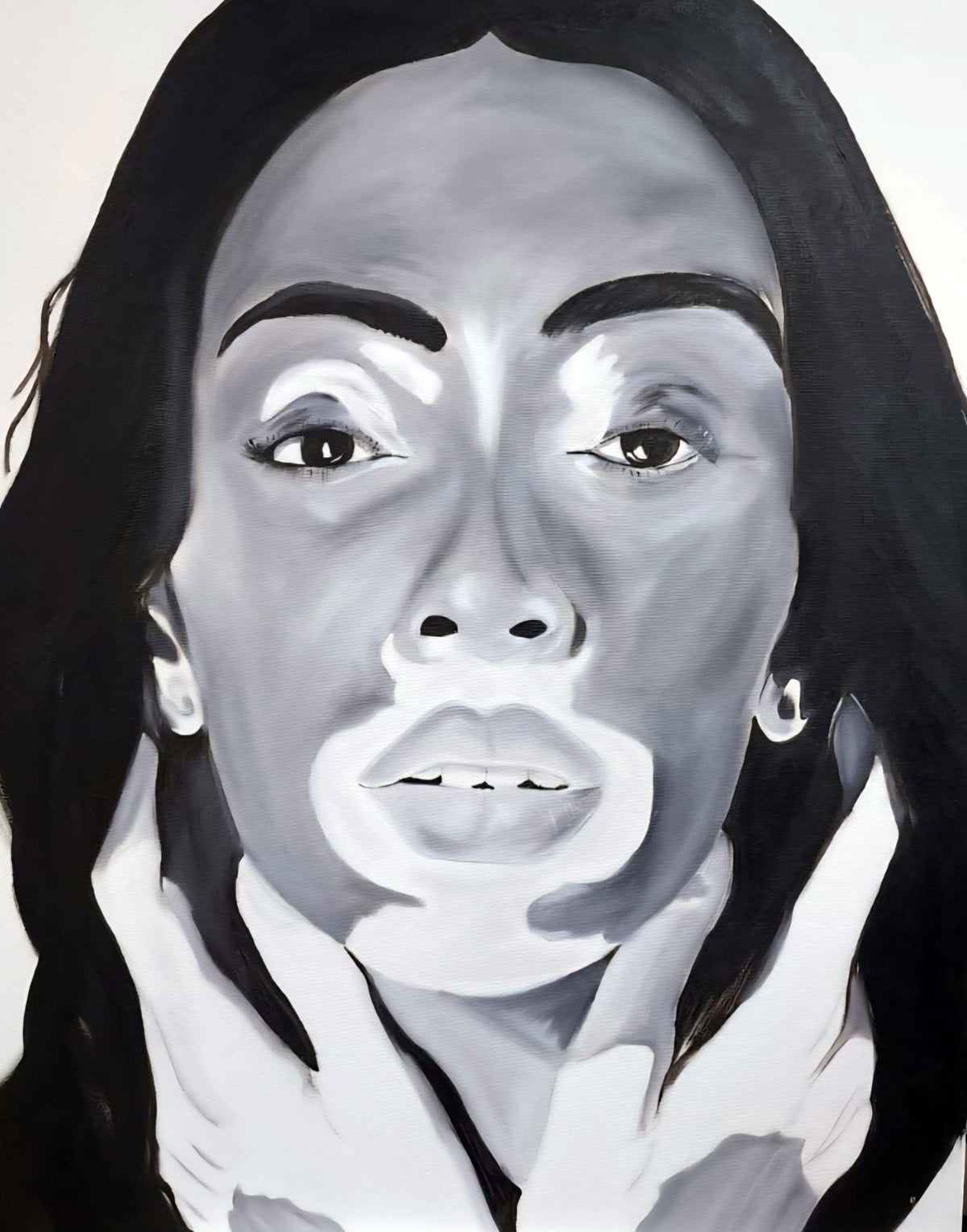 Vitiligo — oil painting by Dana Edri