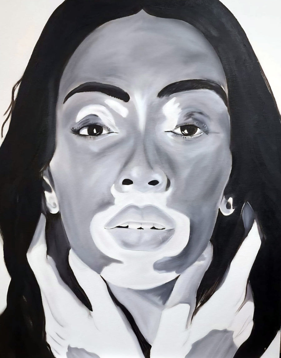 Vitiligo — Hand-Painted Print